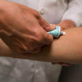 eczema treatment 