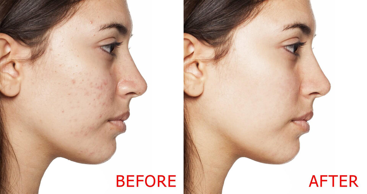 Cytotone Complexion Renewal System